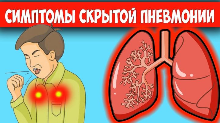 6 признаков скрытой пневмонии