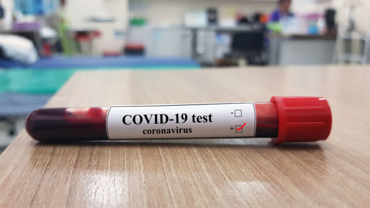 32 новых случая COVID-19 зарегистрировано в РТ