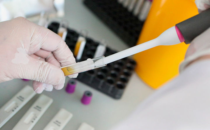 В Татарстане проведено более миллиона ПЦР-тестов на коронавирус