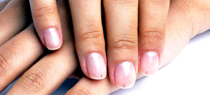 Темные полоски на ногтях являются признаком серьезных проблем со здоровьем