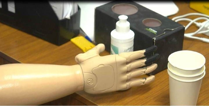 Отделение Социального фонда России по Татарстану обеспечило жителей региона высокотехнологичными средствами реабилитации на 42 миллиона рублей